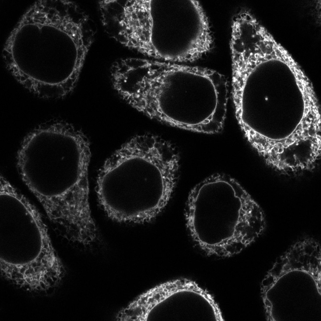 Fluorescence micrograph of several cells, with a fine network around each dark nucleus